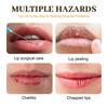EELHOE Honey Lip Oil: Moisturizes, Gently Cares for Dry or Peeling Lips