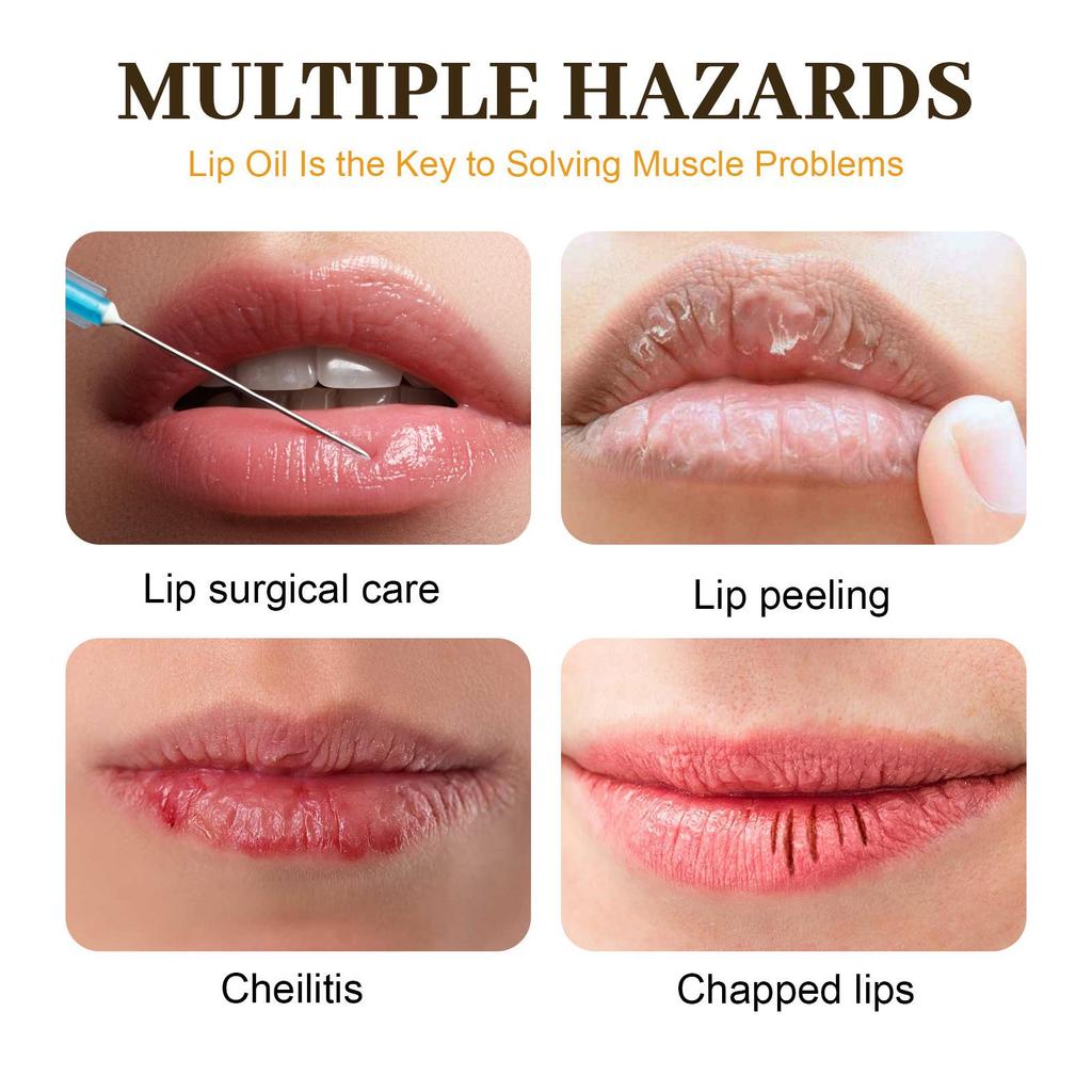 EELHOE Honey Lip Oil: Moisturizes, Gently Cares for Dry or Peeling Lips