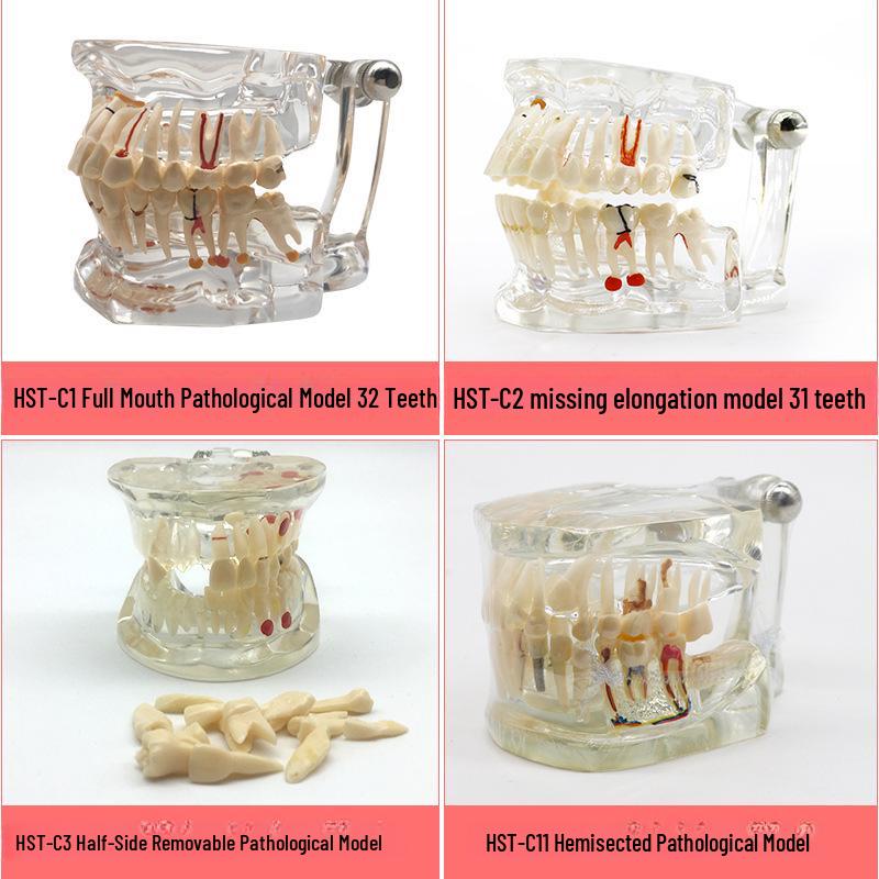 Dental Educational and Communication Model Set: Comprehensive, Removable, and Implant Restoration Models