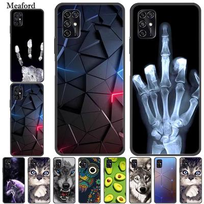 Voor ZTE Blade V2020 Slimme Hoes Zwarte Bumper Siliconen TPU Zachte Telefoonhoesje Voor ZTE Blade V20 Smart 8010 Funda Cartoon Coque