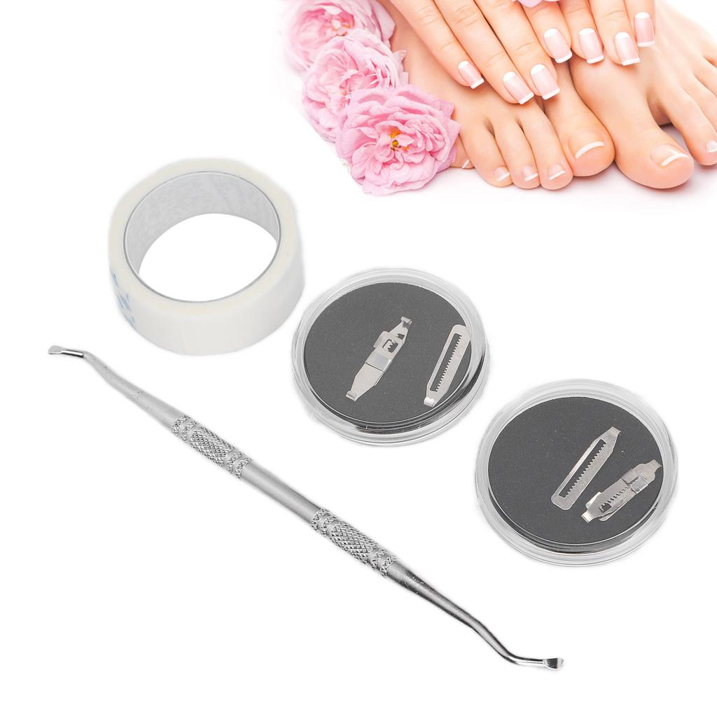 2pcs Ingrown Toenail Corrector Stainless Steel Straightening Pedicure Tool for Paronychia Treatment