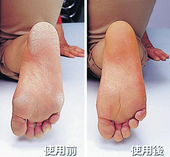 Esthetic Size Socks, Moisturizing, Two-Place Type, Gray, 22.0-25.0cm