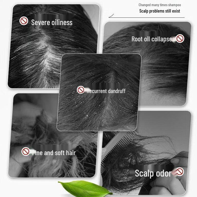 SLEK Anti-Dandruff Oil Control Volumizing Shampoo