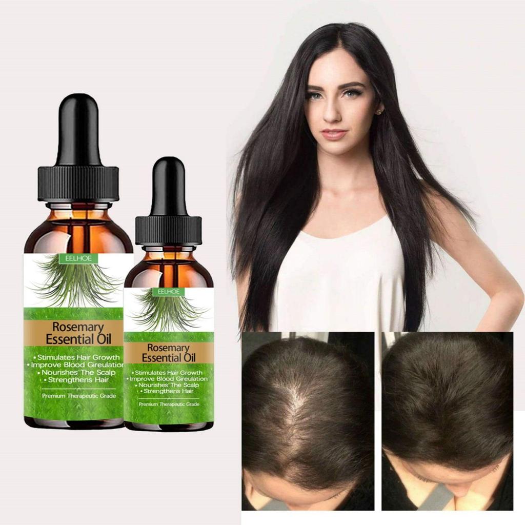 Rosemary Hair Care Essential Oil Hair Growth To Prevent Hair Breakage Nti-frizz Hair Smooth Serum Hair Loss Nourish Replenish