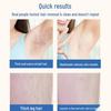 Portable IPL Hair Removal Device - Women's Home Use Laser Epilator