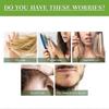 1-3x Rosemary Oil For Hair And Scalp-hair Oil For Hair Loss To Stimulate Hair Growth With Castor Oil 50Ml