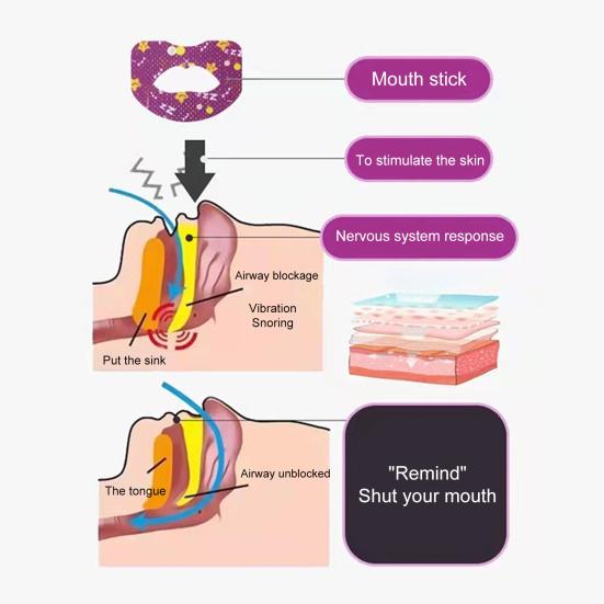 1 Box Breathable Universal Practical Comfortable Mouth Correction Stickers Good Slumber Patch Product Mouth Orthosis Tape