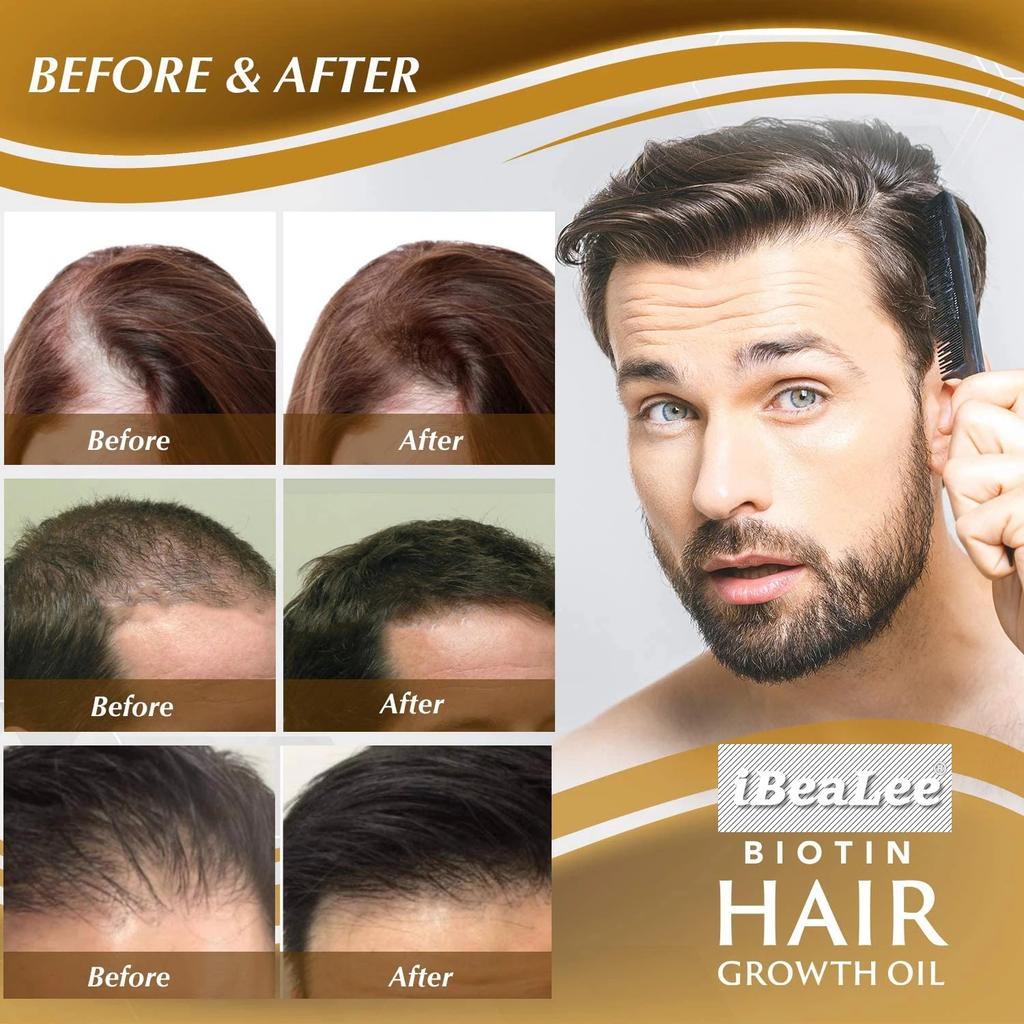 iBeaLee Hair Strengthening Serum Anti-Hair Loss Nourish Roots Scalp Massage Nutrient 100ml