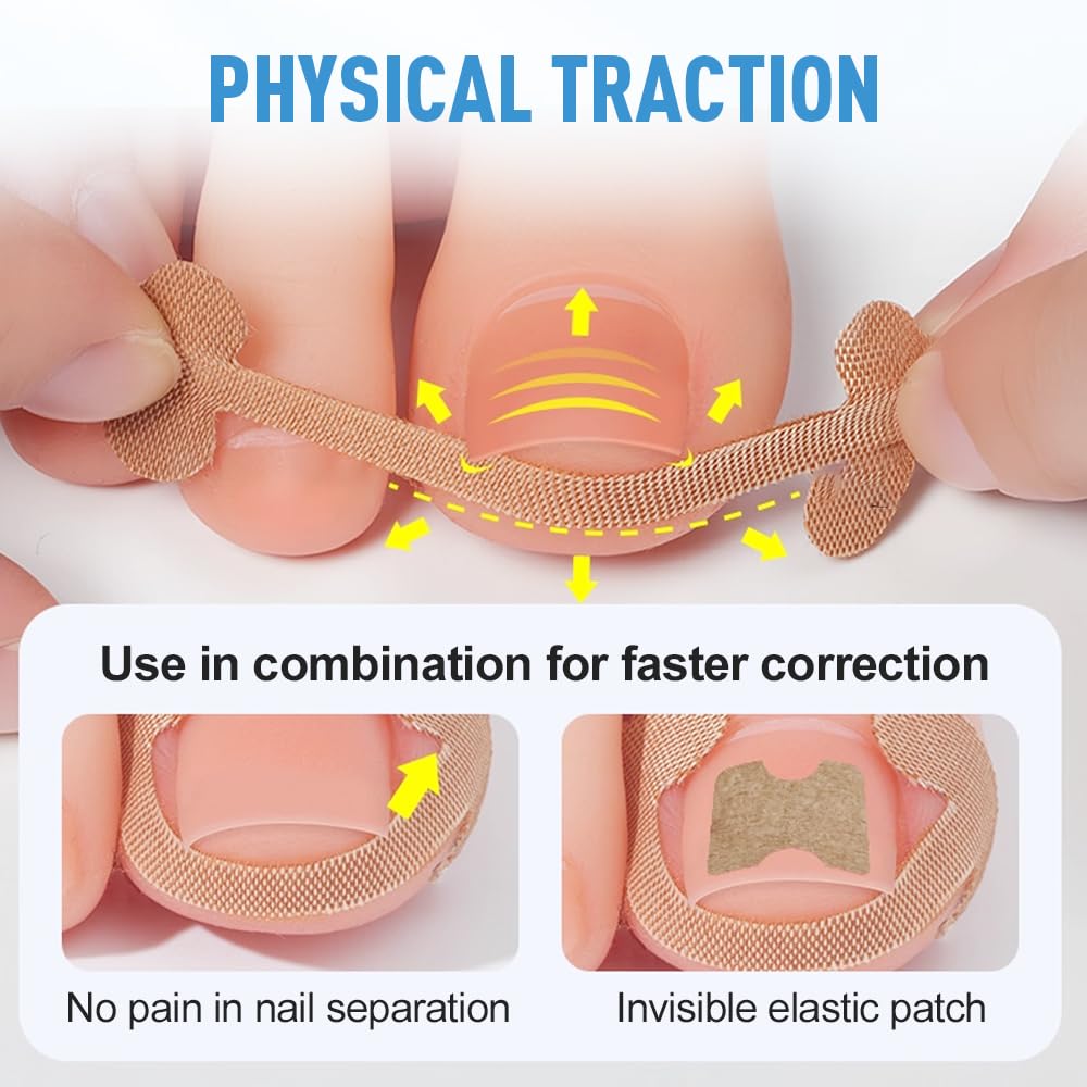 Professional Ingrown Toenail Set with Breathable Ingrown Toenail Strips, Curved Toenails Corrector Patch, Painless File and Lifter Pedicure Tools
