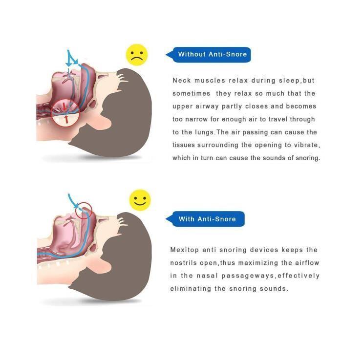 Effective Anti Snoring Nose Clip Instant Aid for Natural Snoring Relief Improve Breathing (Blue)