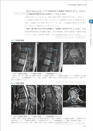 First of All, Let's Start with the Basics: Spinal Imaging Diagnosis