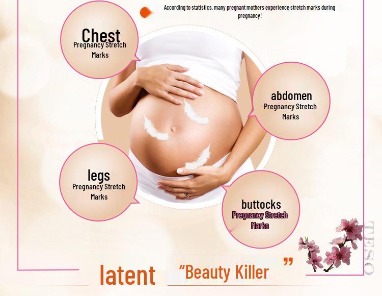 Postpartum Stretch Mark & Scar Repair Cream: Fade Pregnancy Scars & Fat Lines, Tighten & Soothe Skin