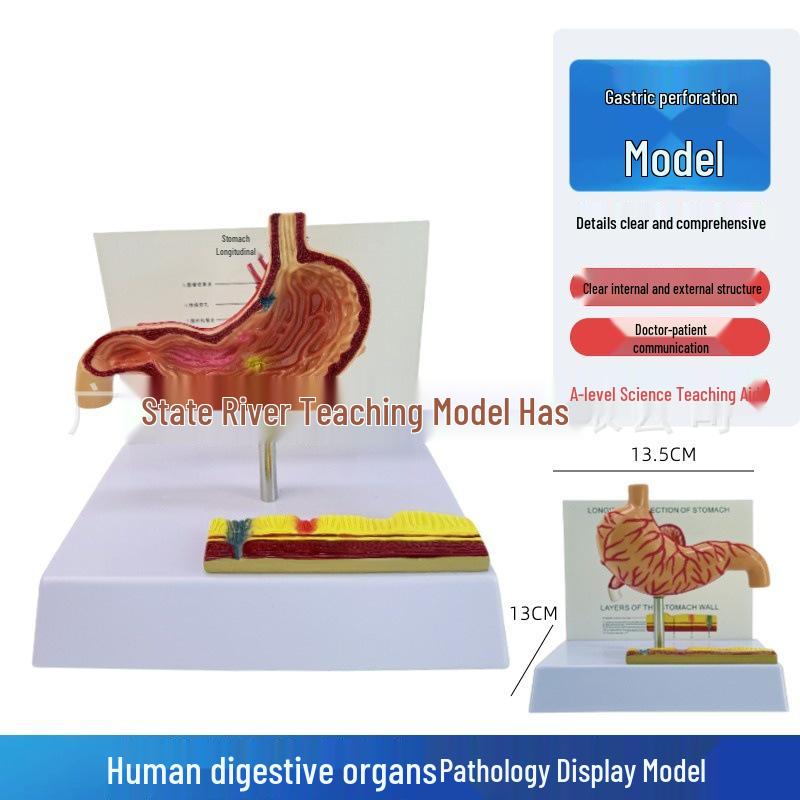 Stomach Pathology and Anatomy Model: Gastroenterology Teaching Aid