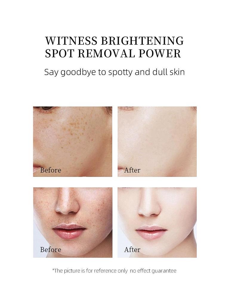 Niacinamide Whitening & Spot-Removing Face Cream: Skin Brightening & Repair