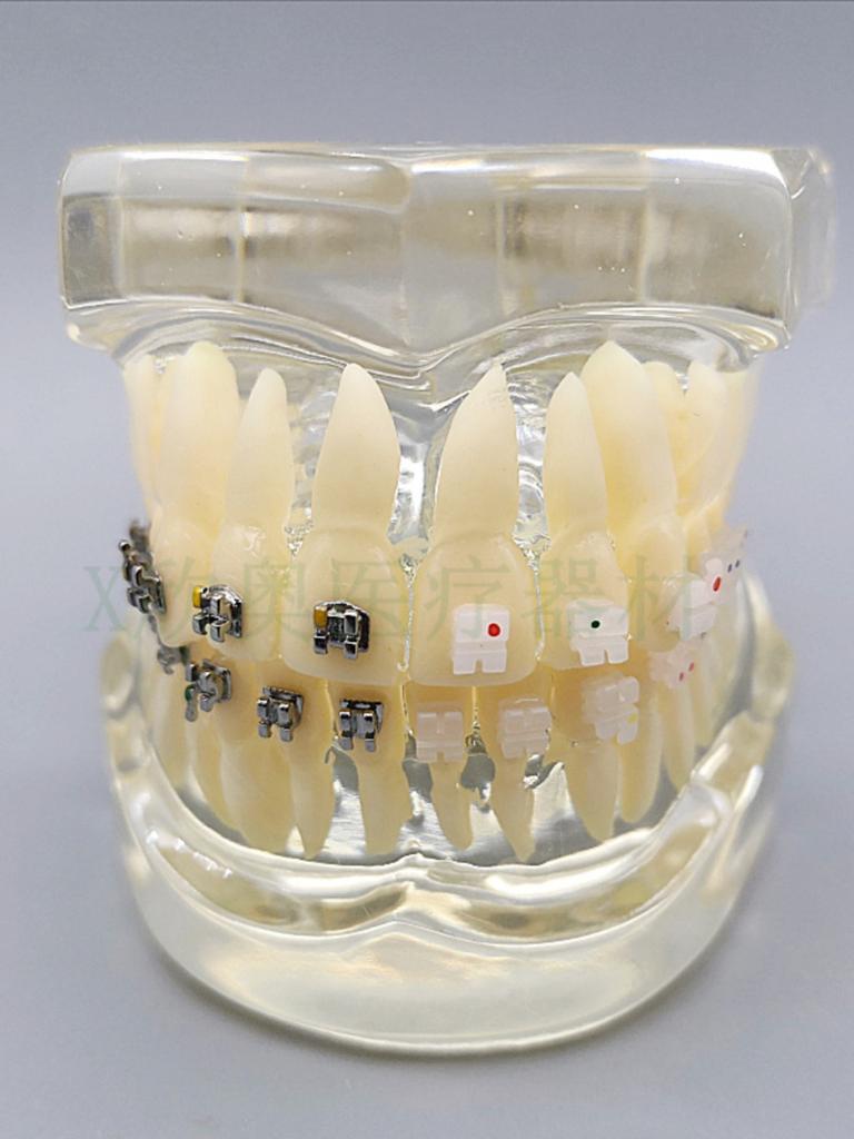 Zahnmedizinisches Lehr-Modell Ortho Metall/Keramik Mit/Ohne Bracket Zahnmedizinische Zubehörteile Kieferorthopädie Zahnersatz Modellierwerkzeug