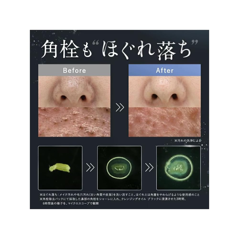SHIRORU Official Cleansing Oil Black: Cleansing oil, cushion oil, pore cleanser, no double