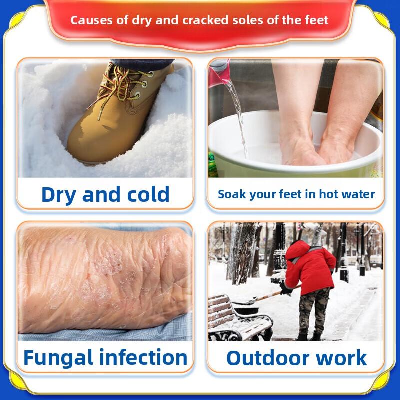 Organic Herbal Cream - Repair & Nourish Dry Cracked Hands & Feet