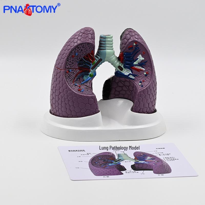 Human Lung Model: Healthy vs. Smoking Lesion for Respiratory Teaching