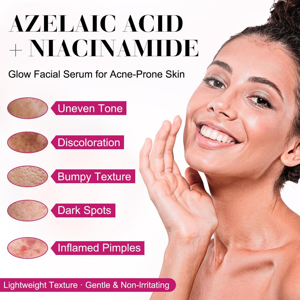14% Azelaic Acid Cream-Brighten Dull Skin-Boost Skin Radiance-Minimize Blemishes-Suitable For Acne Prone Skin, 60g