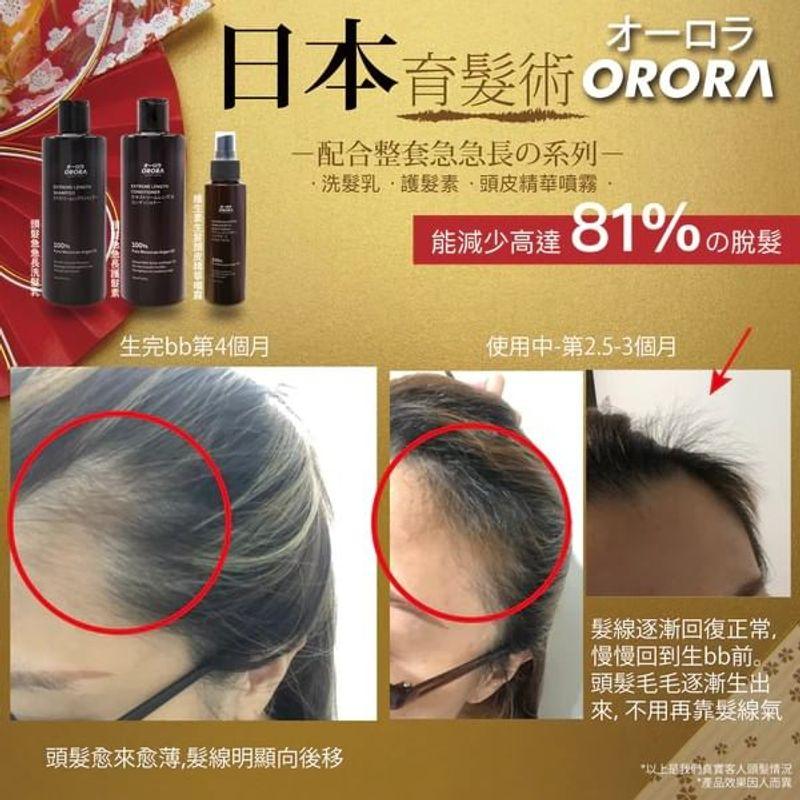 ORORA - Extreme Length & Anti Hair Loss Shampoo