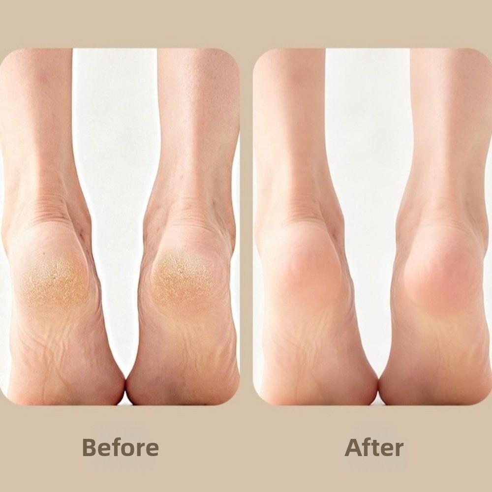 With Handle Pedicure Scraper Foot File Ergonomic Foot Grater  Pedicure Rasps