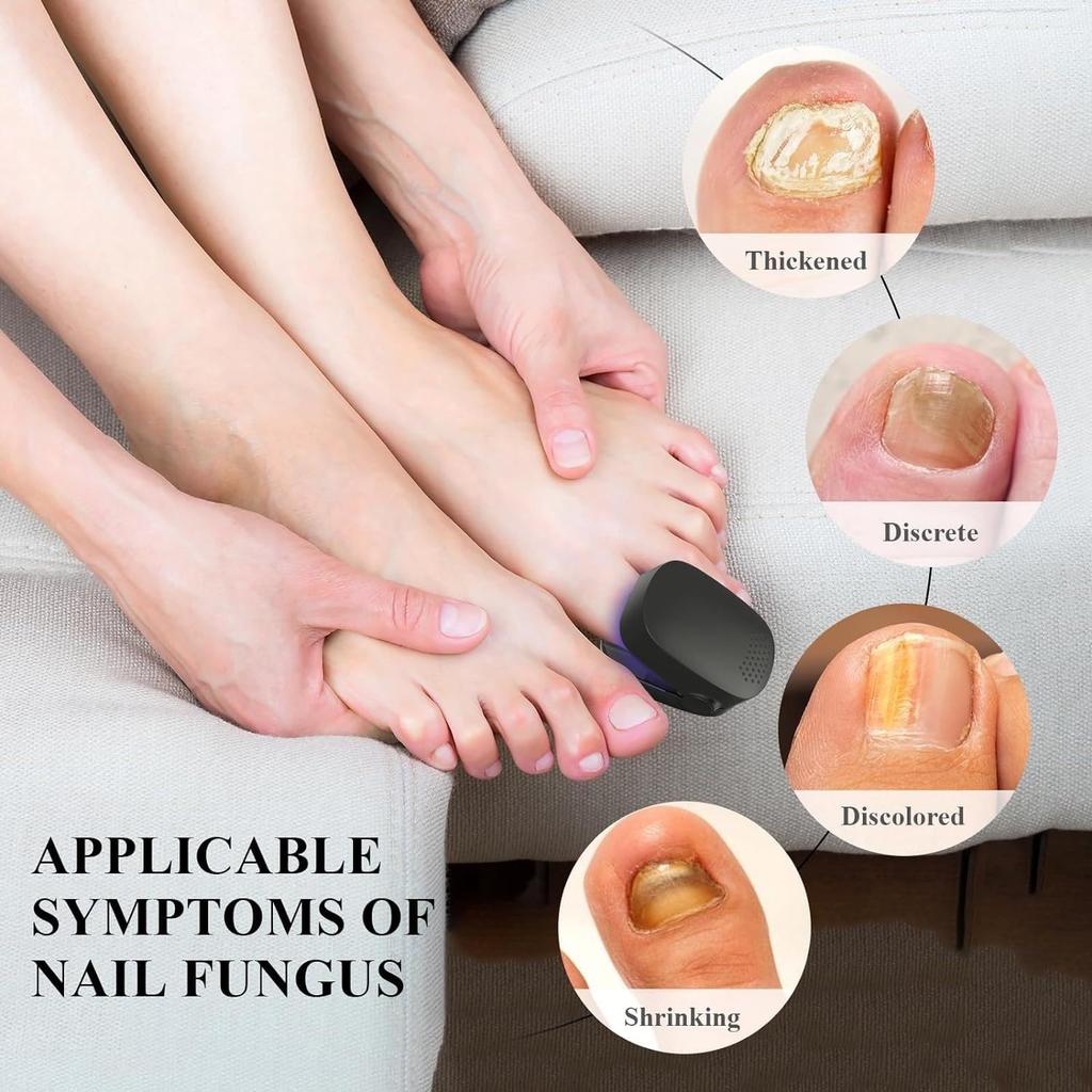 Nail Fungus Cleaning Laser Light, Used For Onychomycosis, USB Charging 905nm Infrared Light 470nm Blue Light