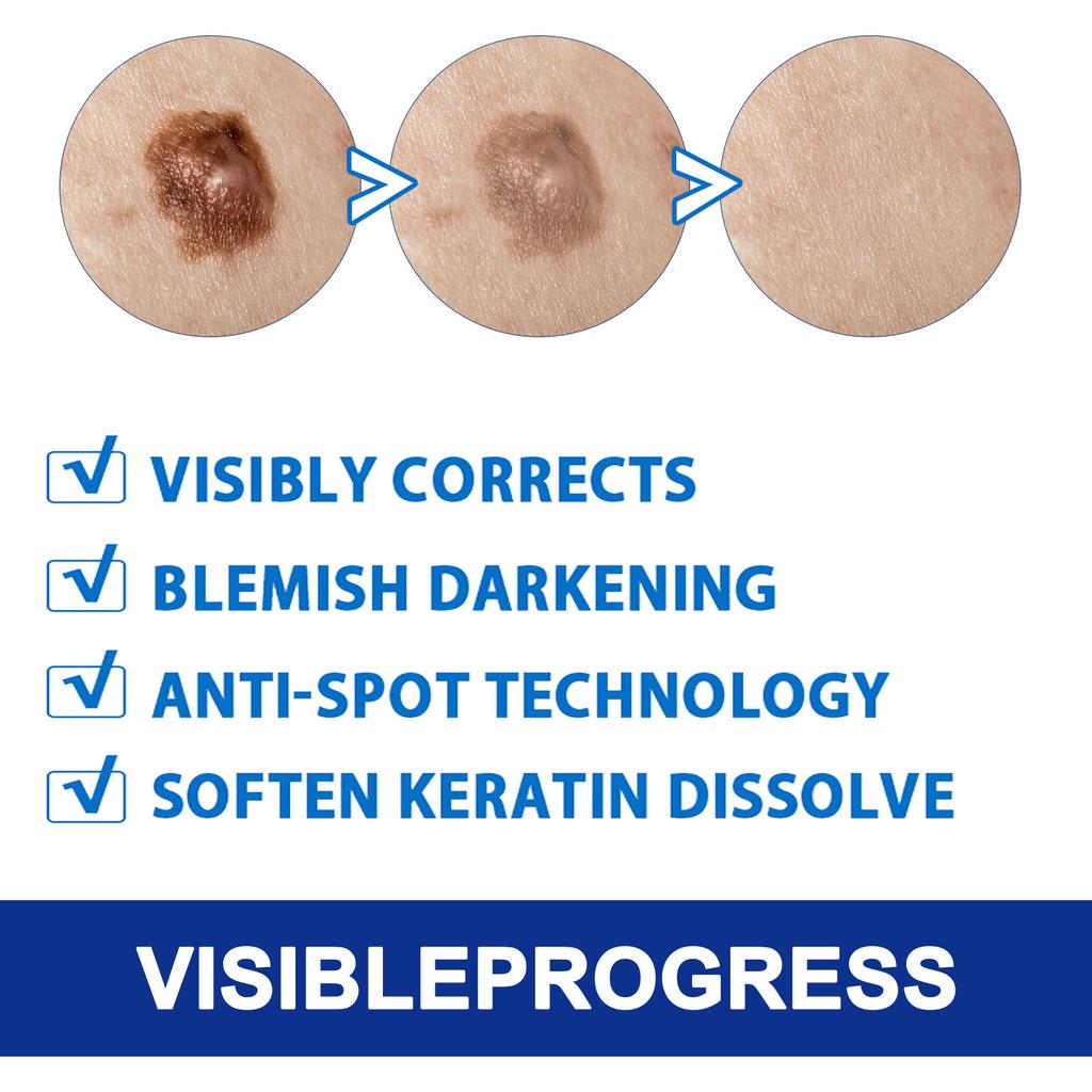 Hautglättende Pflegecreme Verbessert den Hautzustand Feuchtigkeitsspendende Pflege Narbenmildernde Narbenentfernungs-Pflegecreme