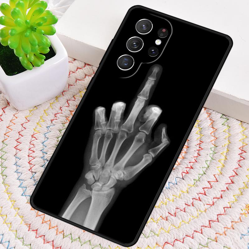 X-ray Hand Bones TPU Phone Case For Samsung Galaxy Note 10 Pro S26 S25 S24 S23 S22 Ultra Plus S21 FE S20 Shockproof Cover
