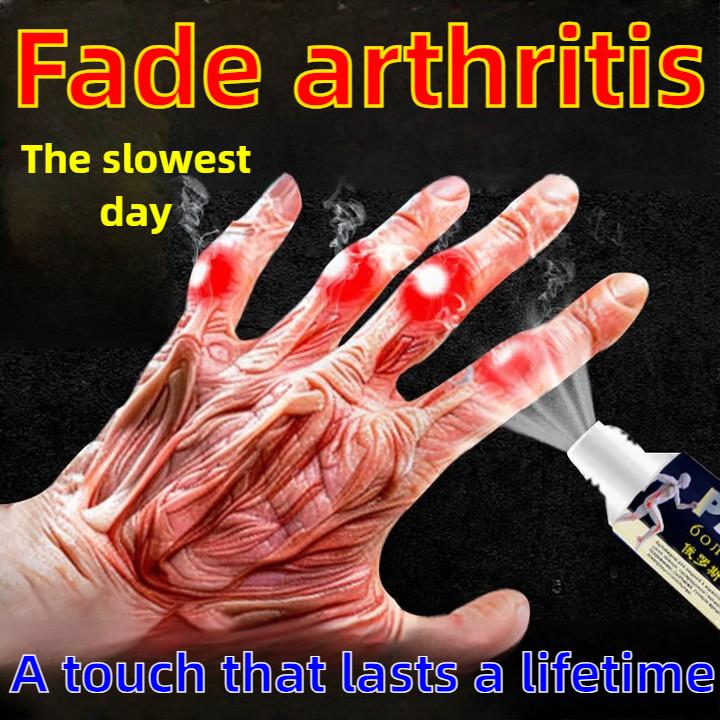 Finger Arthritis, Pain, Swelling, Difficulty Bending, Stiffness and Deformation, Finger Joints, Pain Relief, Special Ointment