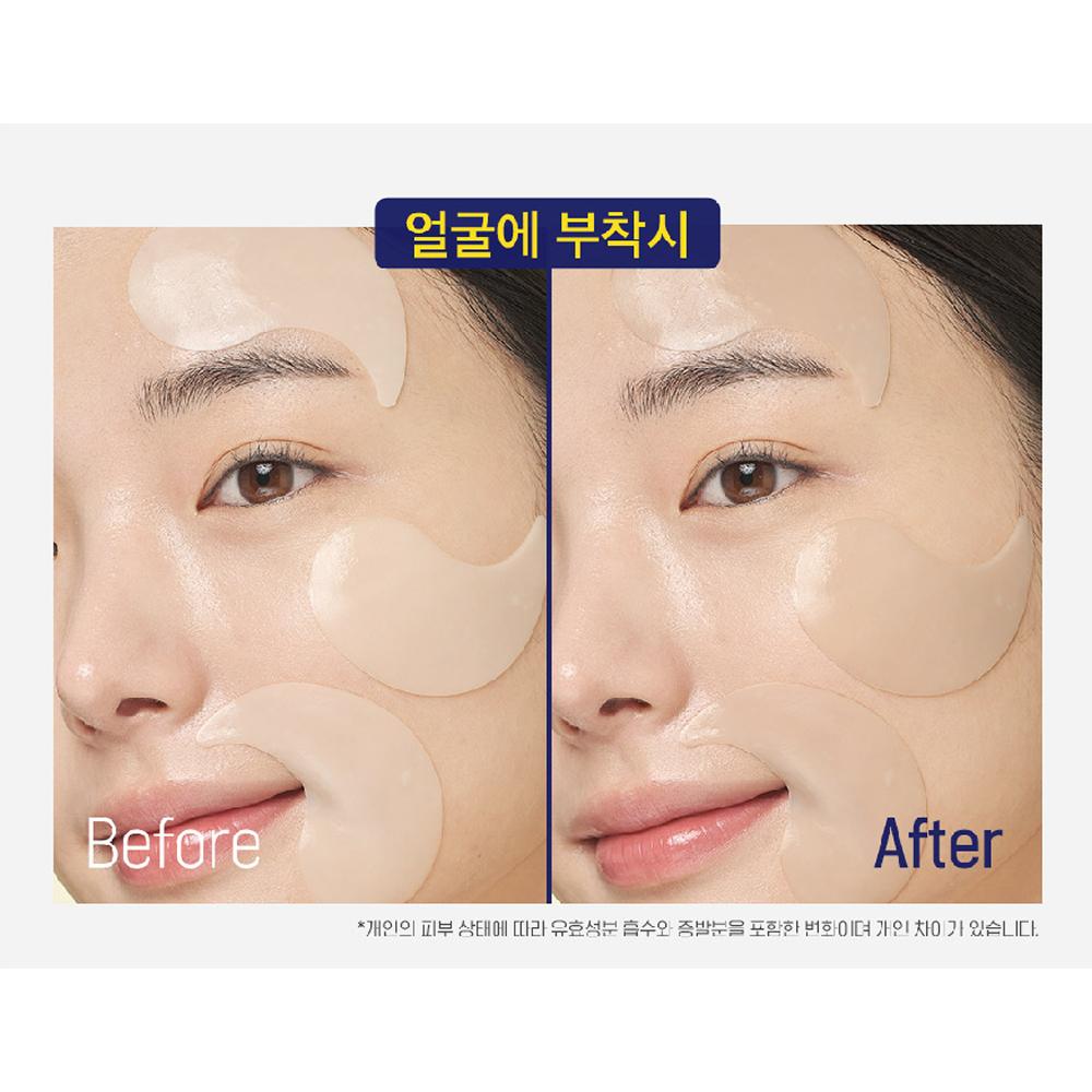 CKD Vita Cica Triple Scar Patch 60patches