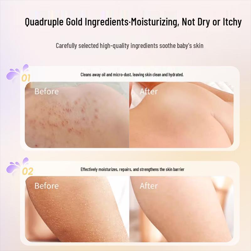 Peiqi Dingding Kinder-Centella Asiatica Hautpflege