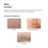 Minimalist Marula Oil 5% Face Moisturizer For Dry Skin With Hyaluronic Acid Deep Hydration 1.7oz