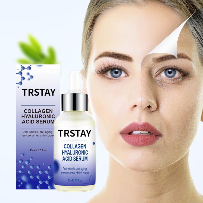 Krém na bělení pih Efektivní odstranění melasmy Krém na tmavé skvrny Vyblednutí Hydratační Rozjasnění Hladká krása Péče o pleť