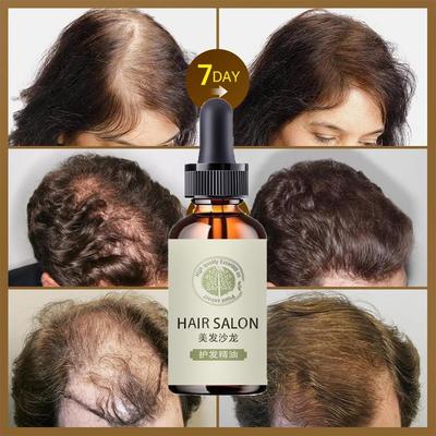 Hair Growth Essence Thick Anti-Alopecia Hair Improvement Hair Loss Hairline Bald Growth Fluid