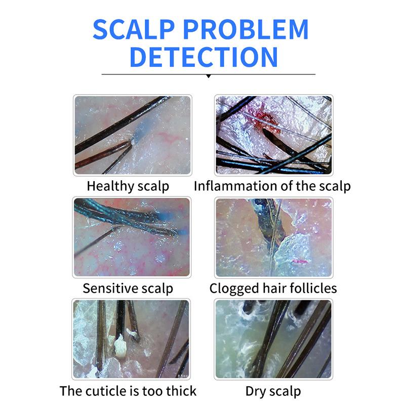 Scalp Hair Follicle Hair Detector Skin Testing Instrument Pore Magnifying Glass Barber Shop USB Connection Mobile Phone High Definition