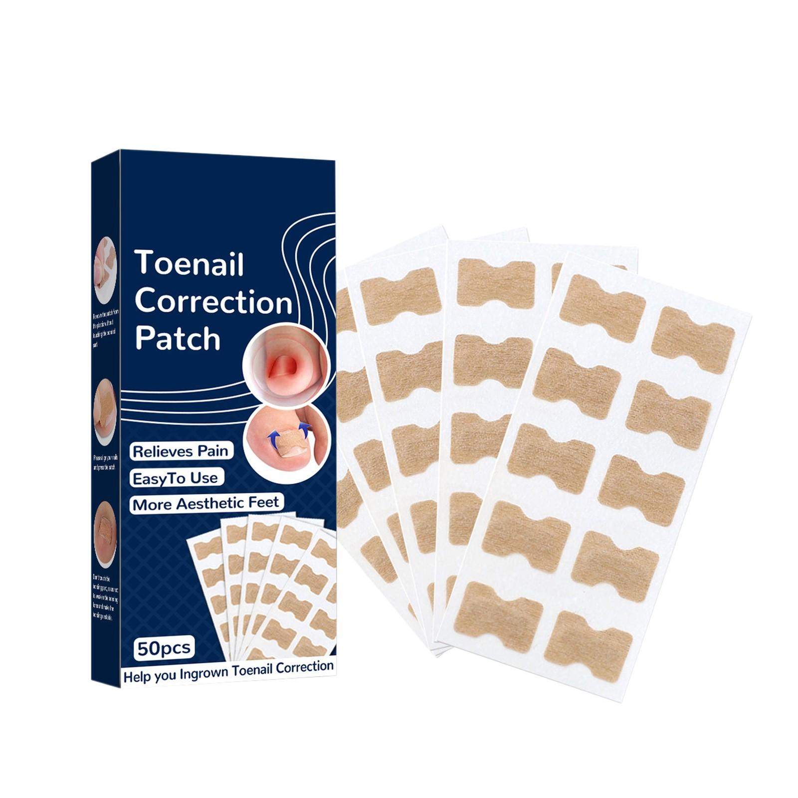 

Наклейки для коррекции вросшего ногтя, бесклеевые корректирующие полоски для вросшего ногтя, корректор для безболезненного педикюра, для ногтей, 50 шт. One Size синий