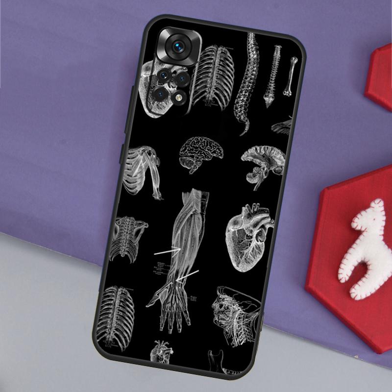 Vintage Anatomical Heart Brain Phone Case For Xiaomi Redmi Note 12 12S 11 11S 10 10S 9 9S 8 Pro Redmi 12 9C 10C 12C Cover