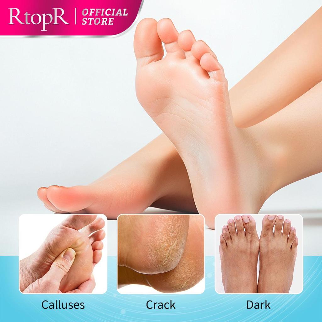RtopR Mango Foot Mask Peel Dead Whitening Moisturizing Exfoliating Renewal Pedicure Remove Dead Skin Heel Socks Peeling Foot Care