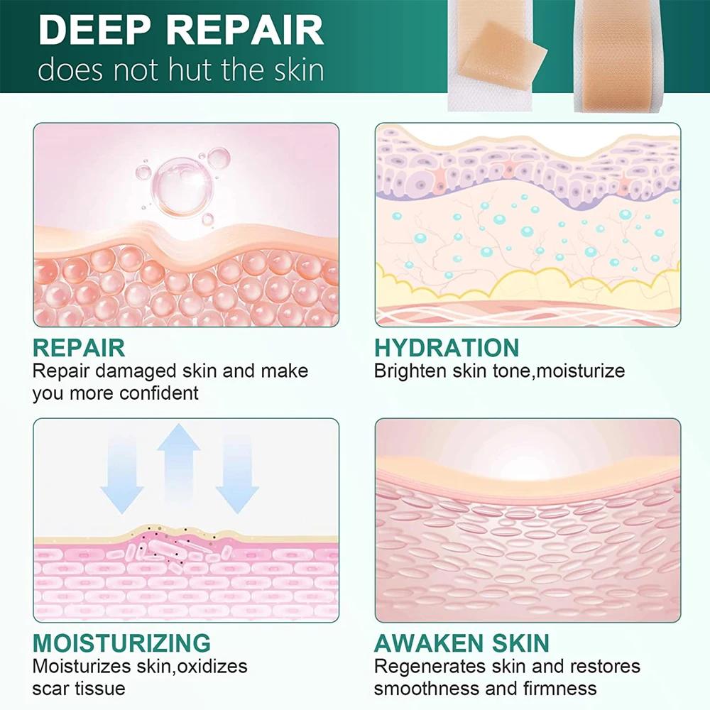 1 Roll of Silicone Scar Patch Silicon Gel Scar Patch Reusable Scar Tape, Skin Care Patch