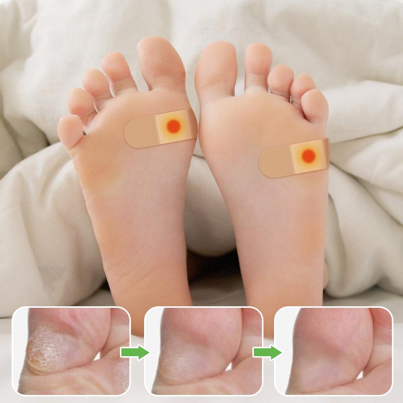10/20/30/50Pcs Mesh Round Corn Remover Pads Foot Corn-Callus Plaster With Hole Corn Cushions Patches Shoe Foot Care Products