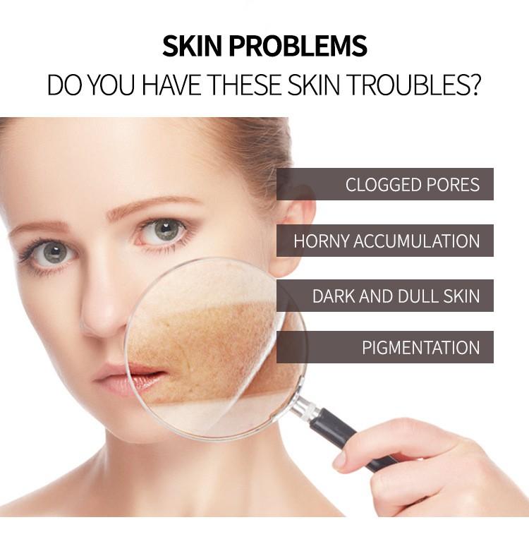 Coffee Face Scrub, Vegan Exfoliating Scrub For Smooth And Glowing Skin | Fights Blackheads, Enlarged Pores, Wrinkles And Fine Lines,150ml