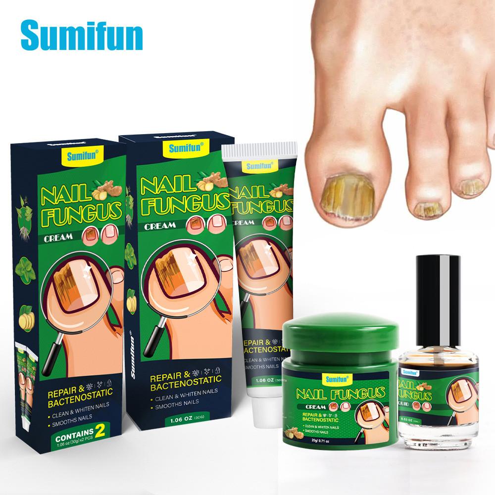 Sumifun Nail Care Ointment With Soothing Formula For Foot And Hand Maintenance