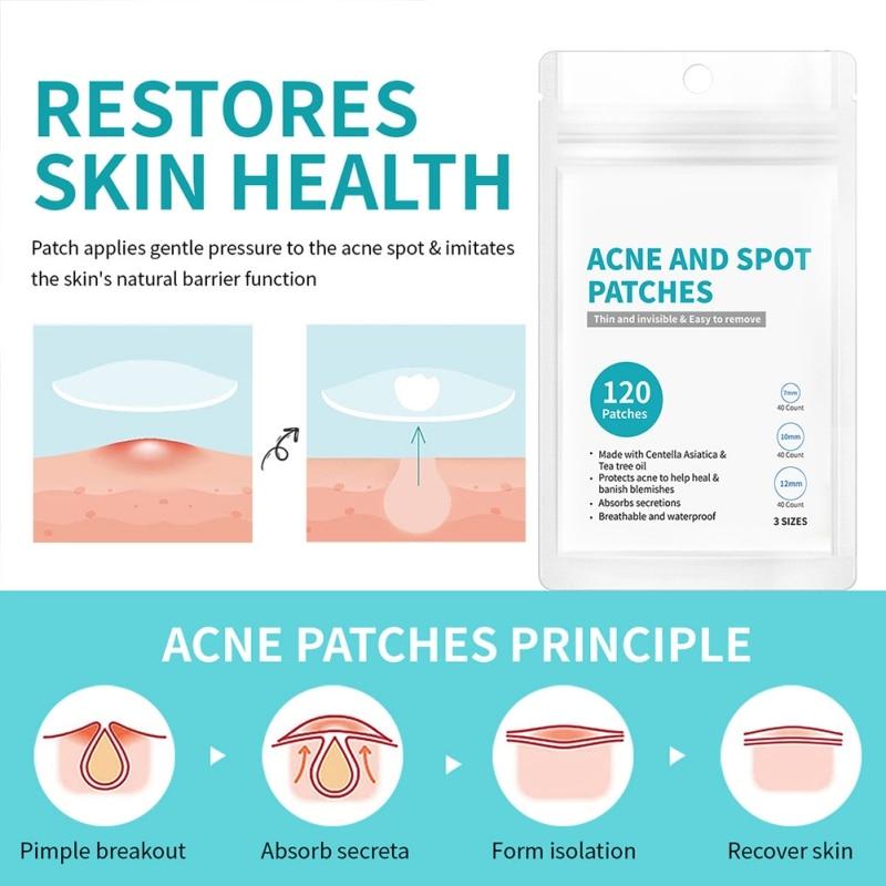 Acne Pimple Patch for Face And Skin Care Dressing for Zits And ...