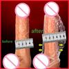 Penis Enlargement Sleeve Thickened Cock Ring Penis Extended Delay Time Sex Toys Lock Semen Adult Sex Products Penis Extension