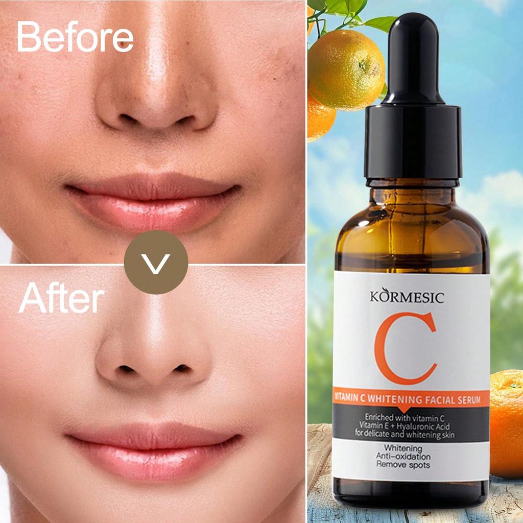 1PC Vitamin C Facial Serum, Facial Care, Moisturizing And Hydrating,Reducing Yellowing,Enhances Radi