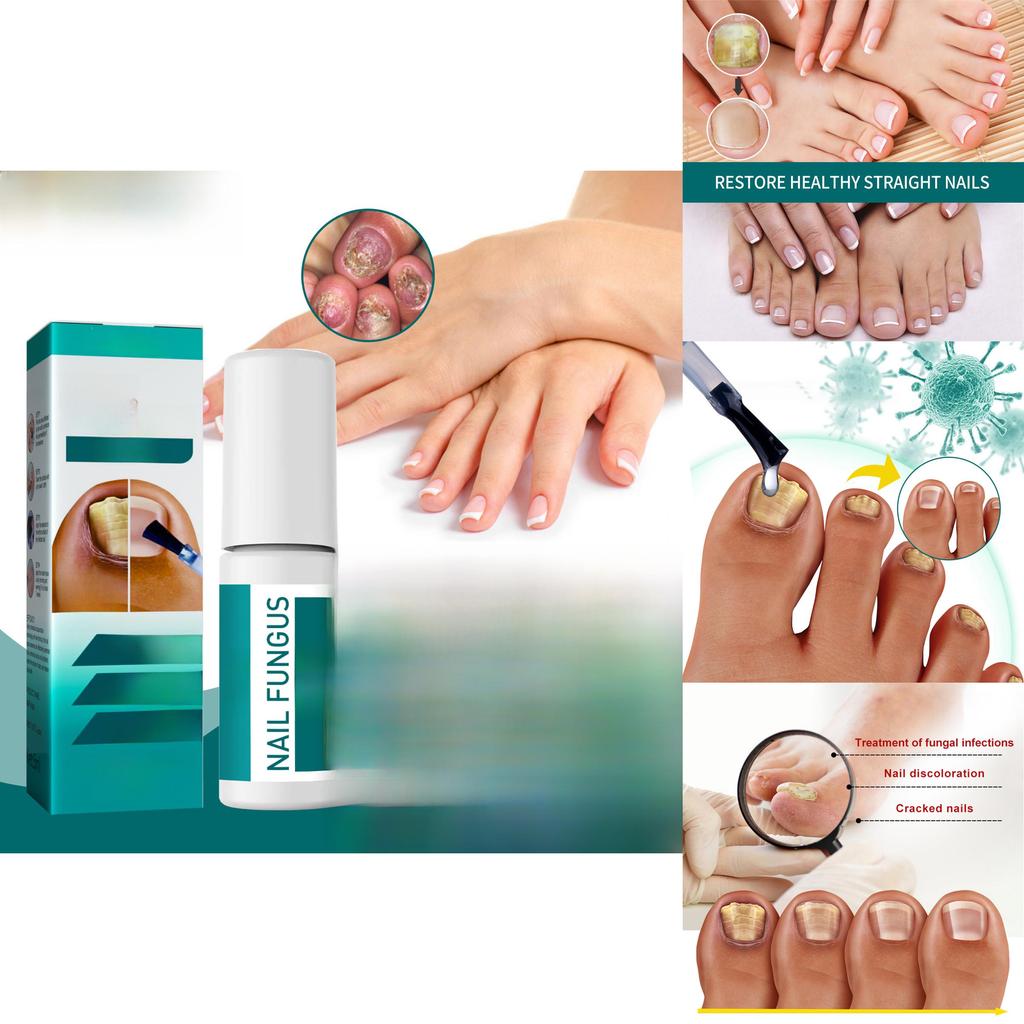 Преміальний розчин для відновлення нігтів на ногах 5 мл Для знебарвлених нігтів і пом'якшення нігтів