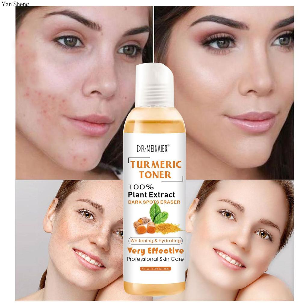 Turmeric Toner Moisturizing Moisturizing Firming Moisturizing Cool Skin Softening Essence 118ml