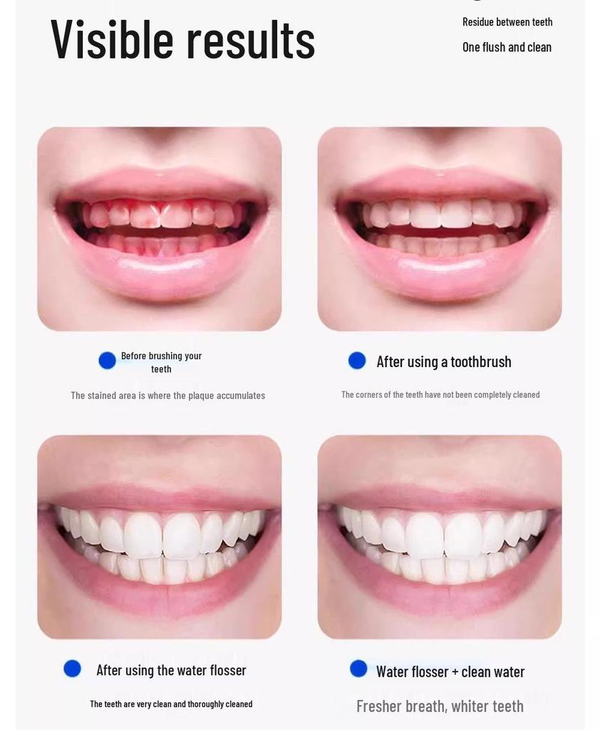 Portable Dental Water Flosser for Calculus Removal and Teeth Cleaning with Battery-Powered Oral Care Scaler