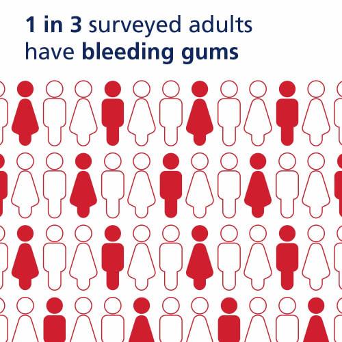 Parodontax Gum & Gingivitis Toothpaste Clean Mint, 3.4 Oz Bleeding, 1 Bottle (x 1)