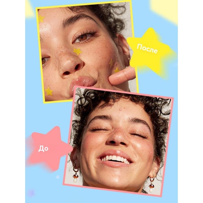 Hydrokolloid-Akne-Pflaster, Farbe: fünfzackiger Stern, transparent, unsichtbar, Reparatur, Eiter, Saug-Akne-Pflaster